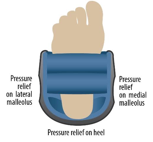 Heel and Ankle Protector A66887